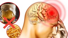 6 loại thực phẩm gây nguy hại cho trí nhớ