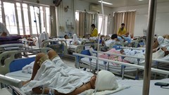 Trẻ 12 tuổi bị lột da đầu, mất hoàn toàn 2 tai do chó cắn