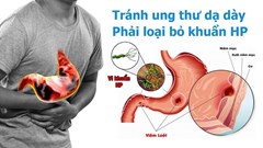 85,8% người lớn nhiễm vi khuẩn HP – nguyên nhân gây ung thư dạ dày
