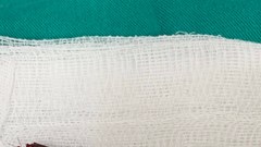 Mâu thuẫn trong đám cỗ, một thanh niên bị đâm xuyên tủy sống bằng que xiên thịt