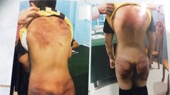 Mạnh tay xử lý hành vi bạo hành, xâm hại trẻ em