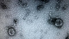 Việt Nam nuôi cấy và phân lập thành công virus corona mới (nCoV)