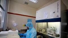 Bệnh viện Trung ương Huế xét nghiệm chẩn đoán được nCoV