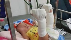 TP.HCM: Khởi tố người đàn ông bạo hành con ruột