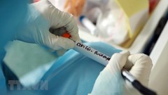 Khoảng 30 địa chỉ ở Việt Nam có thể xét nghiệm Covid-19