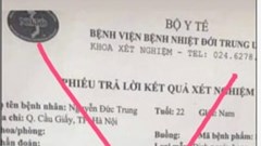 Buộc một “KOL” gỡ bỏ 216 bài xuyên tạc về dịch Covid-19  trên facebook
