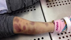 Chủ tịch TP Hà Nội yêu cầu điều tra, xử lý nghiêm bố mẹ bạo hạnh con đến tử vong