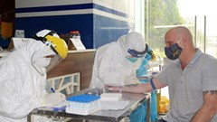 Bệnh nhân Covid – 19 người Thụy Điển ủ bệnh từ trước hay lây nhiễm tại Hà Nội?