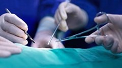 Chuẩn bị các phương án ghép phổi cho BN 91