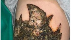 Dễ xăm, khó xoá