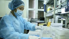 Rà soát năng lực xét nghiệm virus SARS-Cov-2 tại địa phương