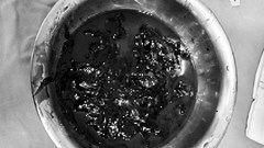 Làm đẹp vùng kín tại cơ sở thẩm mỹ “chui”- nguy hại khôn lường