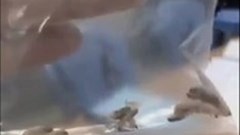 40 con giòi được gắp ra từ  tai người đàn ông ở Quảng Nam