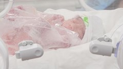 Trên 80% em bé được điều trị thành công nhờ can thiệp y học bào thai