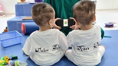 Hai bé Trúc Nhi và Diệu Nhi xuất viện sau ca đại phẫu thuật tách dính liền