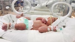 Lần đầu tiên thí điểm mạng lưới sơ sinh Hà Nội