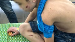 Đề nghị xử lý nghiêm hành vi bạo lực, bóc lột sức lao động trẻ em