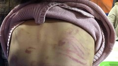 Kinh hoàng cảnh mẹ đẻ cùng người tình dùng dây điện quật nát thịt con gái mình