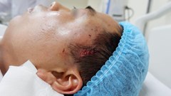 Phẫu thuật thẩm mỹ ở cơ sở tư nhân: “Chữa cháy” ở bệnh viện