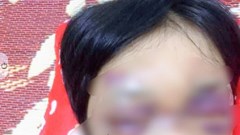 Khởi tố người mẹ hành hạ dã man con gái 6 tuổi