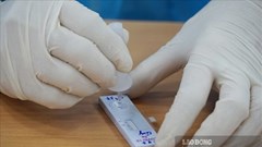 Thêm 24 ca nhiễm SARS-CoV-2 mới, 17 ca ghi nhận tại Bệnh viện Phổi Hà Nội