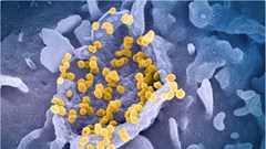 Biến chủng Lambda lan rộng đến 41 quốc gia trên thế giới