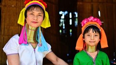 Khám phá 8 “chuẩn mực” cái đẹp kì lạ của các nước Châu Á