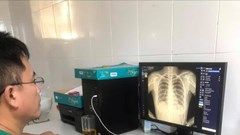 DrAid - ​​Ứng dụng AI chẩn đoán và tiên lượng điều trị Covid-19 đầu tiên tại Việt Nam