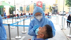 Liên quan đến chùm ca bệnh tại Bệnh viện Việt Đức: Làm quen với trạng thái mới nhưng không được chủ quan