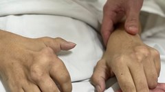 Phòng tránh bệnh gout ở người trẻ