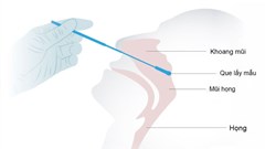 Các bước tự xét nghiệm nhanh Covid-19 tại nhà