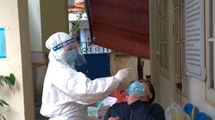 Cơ sở y tế không được thực hiện test Covid-19 mẫu gộp nhưng thu tiền mẫu đơn