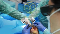 Lần đầu tiên sử dụng công nghệ “Mắt thần” trong thay khớp nhân tạo tại Việt Nam và Đông Nam Á