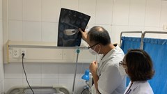 Một phụ nữ bị co giật sau tiêm filler nâng mũi tại spa của người quen