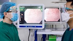 Ung thư đường tiêu hóa: Trì hoãn kiểm tra, hậu quả khó lường