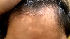 Vụ "Gửi con đi chữa bệnh chậm phát triển rồi… nhận hũ tro cốt ”: Thêm một gia đình lên tiếng tố giác