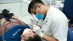 Mất răng, xô lệch hàm răng do thói quen lâu ngày của người Việt