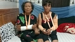 Can ngăn bạo lực gia đình, hai mẹ con bị đánh gãy tay