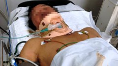 Cứu sống người đàn ông bị tấm tôn cắt đứt cổ