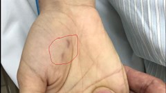 Một bác sĩ thú y tử vong vì bị chó dại cắn