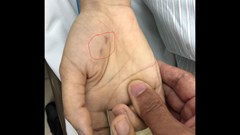 Một bác sĩ thú y tử vong vì bị chó dại cắn