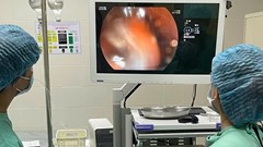 Gắp 3 bàn chải đánh răng trong đường tiêu hóa của bệnh nhân tâm thần