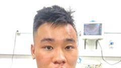Có gương mặt sát nhân không?