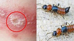 5 bước xử lý đúng cách khi tiếp xúc với kiến 3 khoang