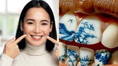 Giới trẻ Trung Quốc rộ trào lưu xăm hình lên... răng