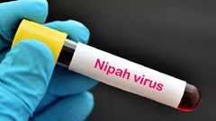 Ấn Độ tuyên bố đã kiểm soát được ổ dịch virus Nipah
