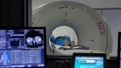 Tăng cân ở tuổi trưởng thành có thể làm tăng nguy cơ ung thư gấp 5 lần