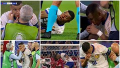 Mbappe bị gãy mũi, tình hình “không ổn“
