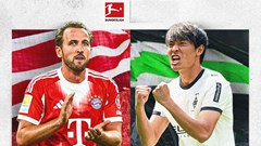 Nhận định trận đấu Bayern Munich vs Monchengladbach, 2h30 ngày 7.3: Chênh lệch đẳng cấp