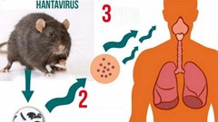 Bộ Y tế cảnh báo khẩn về bệnh do virus Hanta khiến 3 người tử vong trên tàu du lịch, Việt Nam chưa ghi nhận ca bệnh